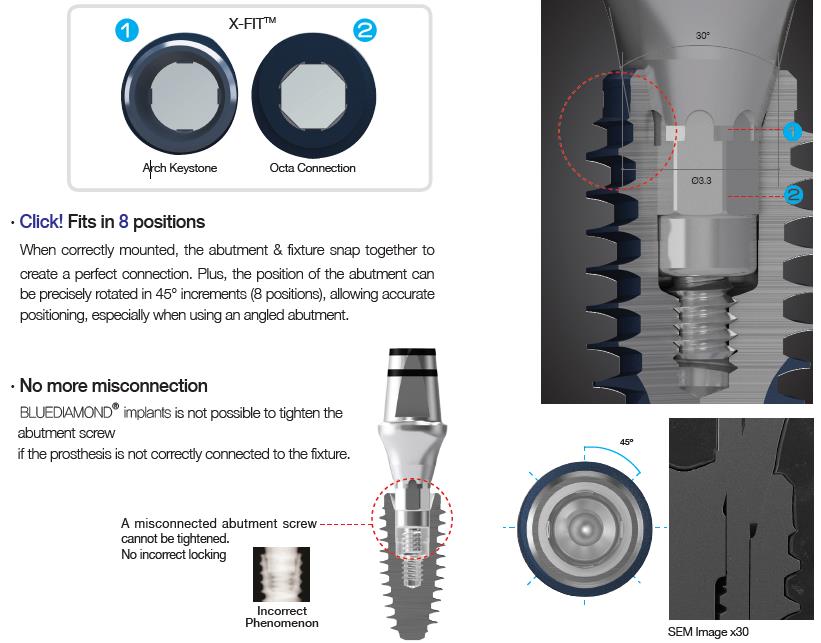 MegaGen Launches 'BLUEDIAMOND IMPLANT®', Masterpiece Of Implant ...