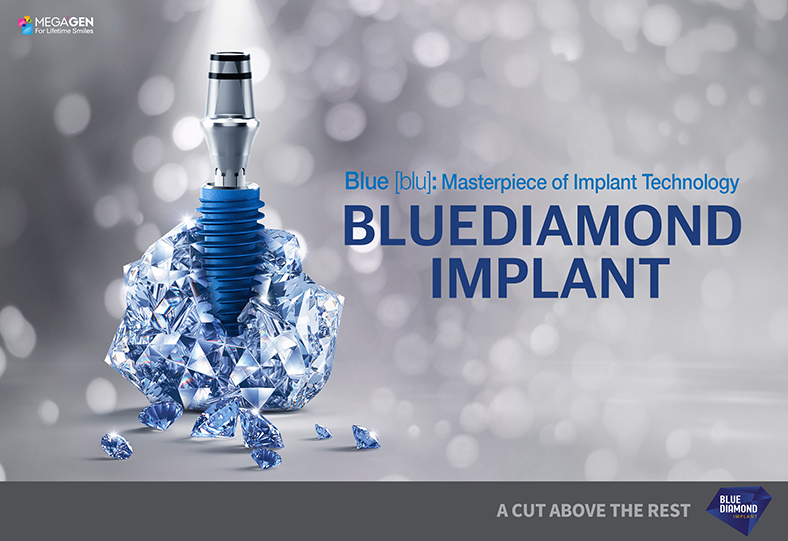 MegaGen Launches 'BLUEDIAMOND IMPLANT®', Masterpiece Of Implant ...