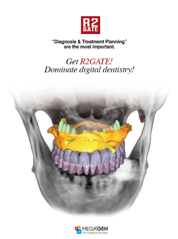 Get R2GATE! Dominate digital dentistry!