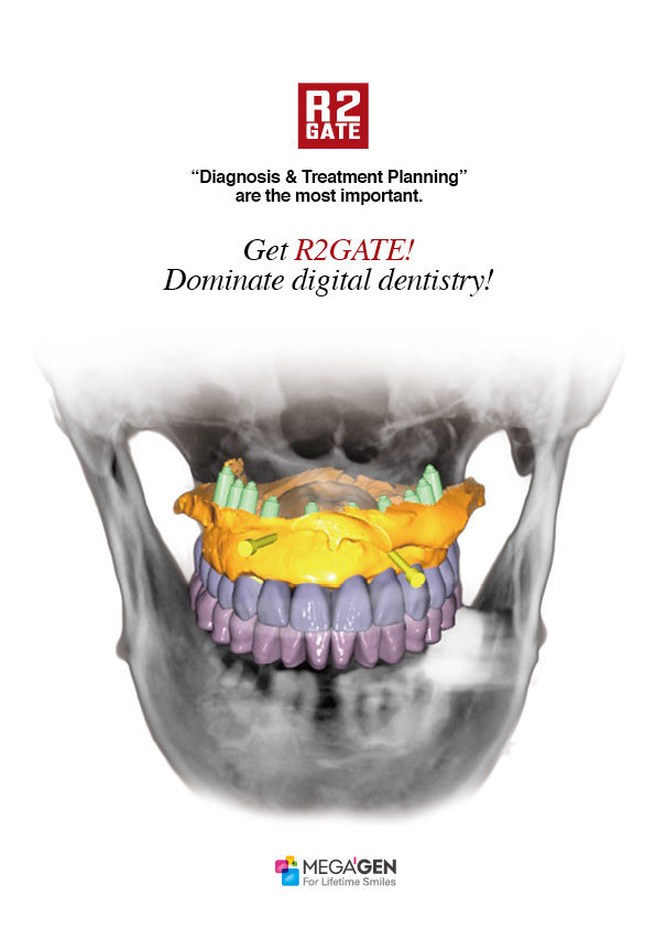 Get R2GATE! Dominate digital dentistry!