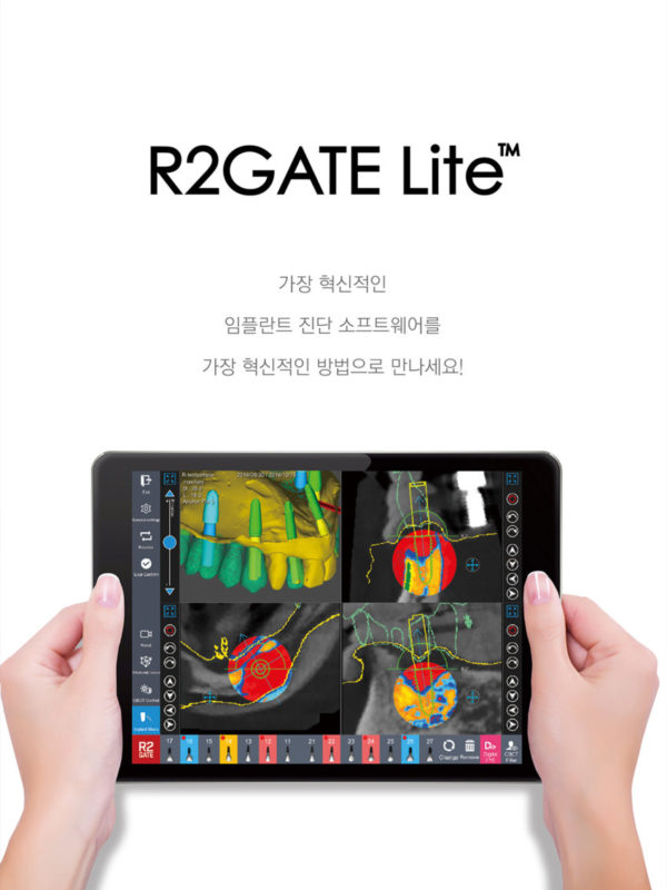 R2GATE Lite 가장 혁신적인 임플란트 진단 소프트웨어를 가장 혁신적인 방법으로 만나세요!