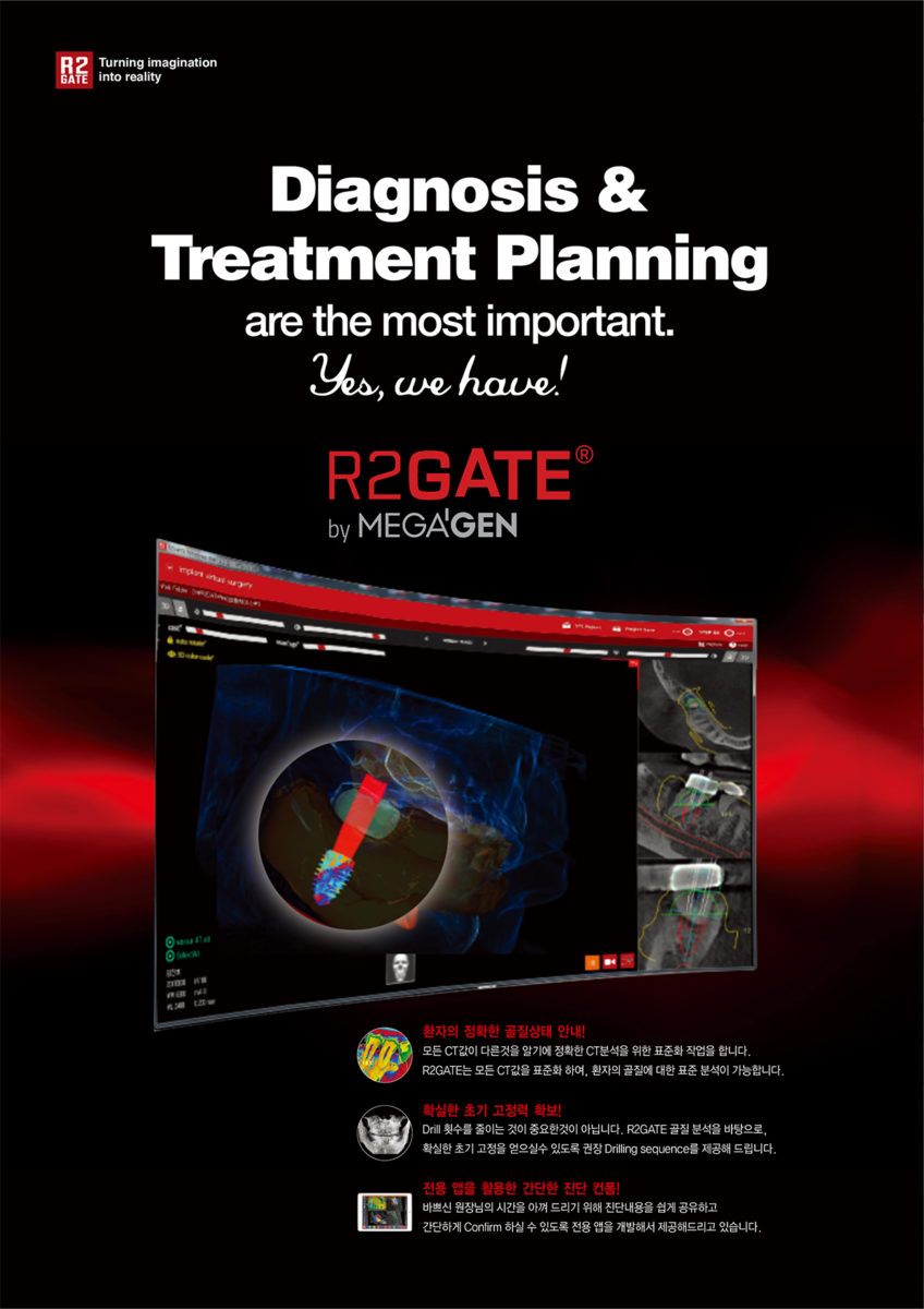 Diagnosis & Treatment Planning are the most important. R2GATE