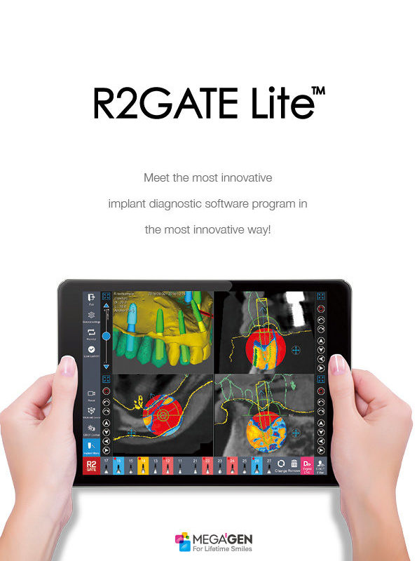 R2GATE Lite