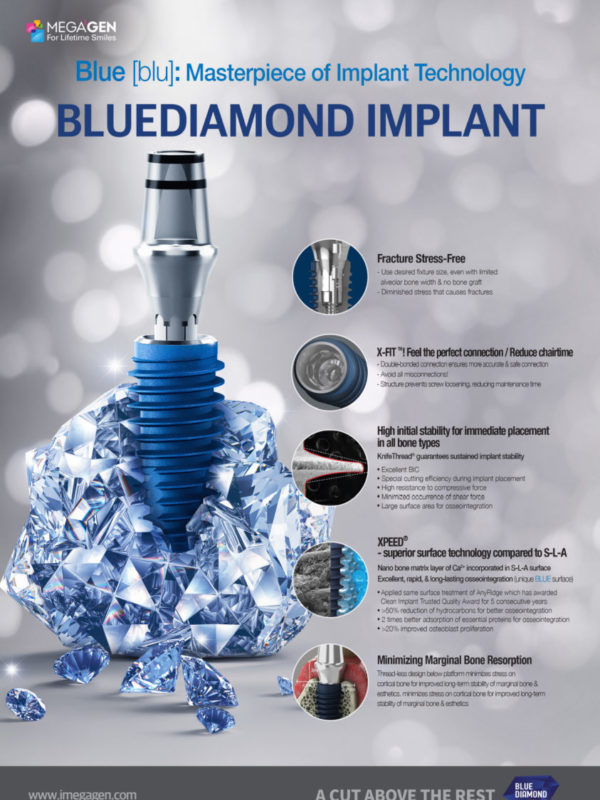 Blue [blu]: Masterpiece of Implant Technology, BLUEDIAMOND IMPLANT