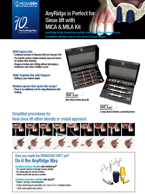 AnyRidge is Perfect for Sinus lift with MICA & MILA kit