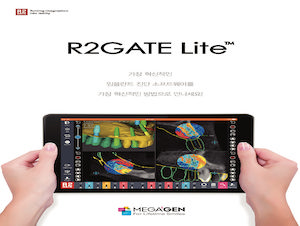 R2GATE Lite Brochure_EN - MEGAGEN IMPLANT