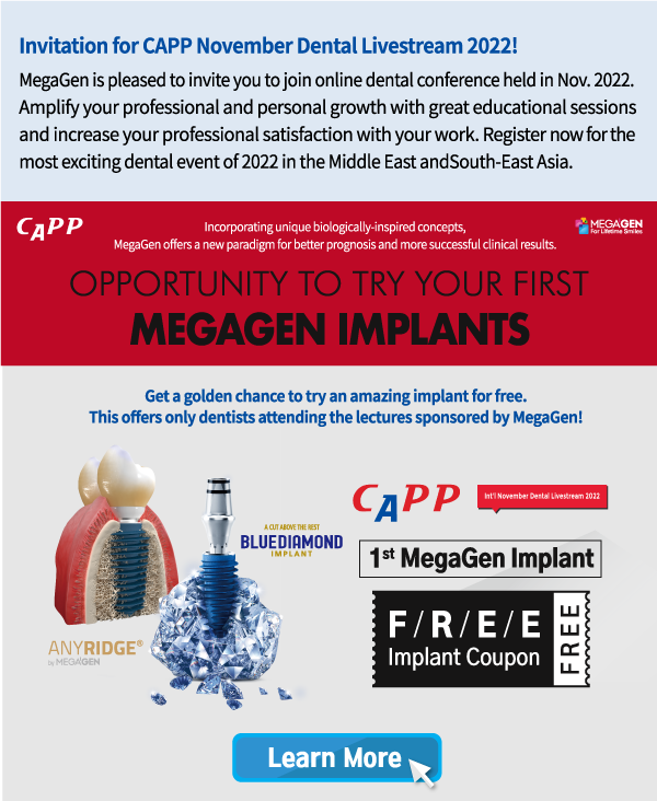 Oppoutunity to try your first MegaGen implat!