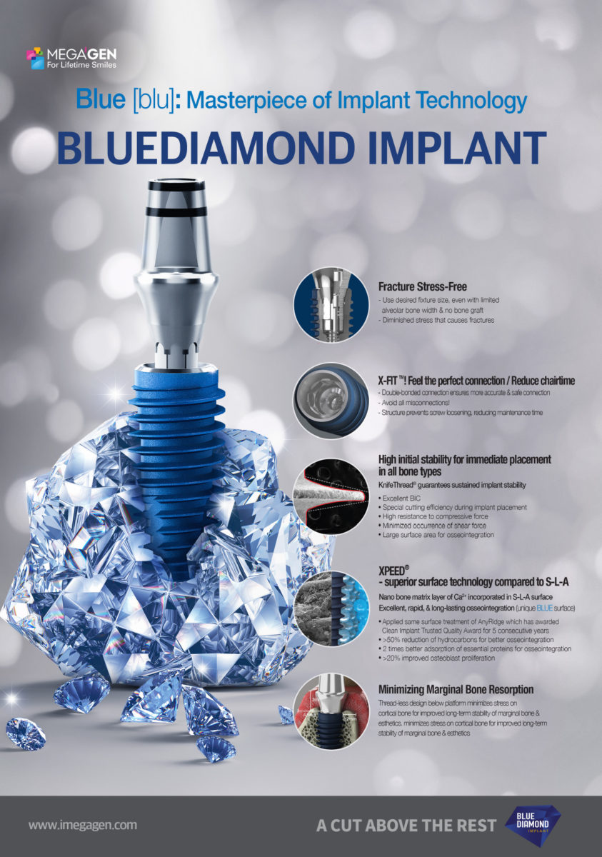 Blue [blu]: Masterpiece of Implant Technology, BLUEDIAMOND IMPLANT